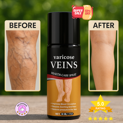 Varicose Veins Calming Spray 💚 | Buy 1 Get 2 FREE 💥